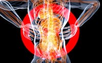 Inflammation